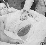 Энн Ходжес.30 ноября 1954 года в нее попал метеорит 